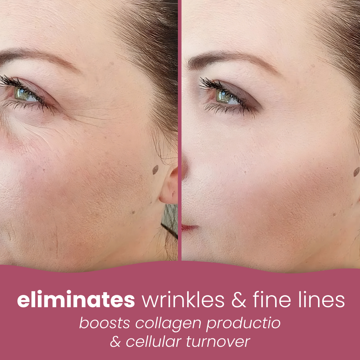 vitamin-c masks