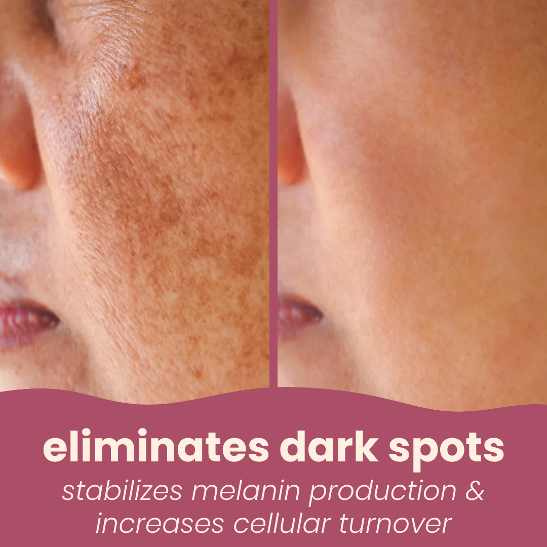 vitamin-c masks