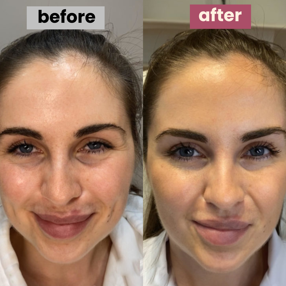 vitamin-c masks