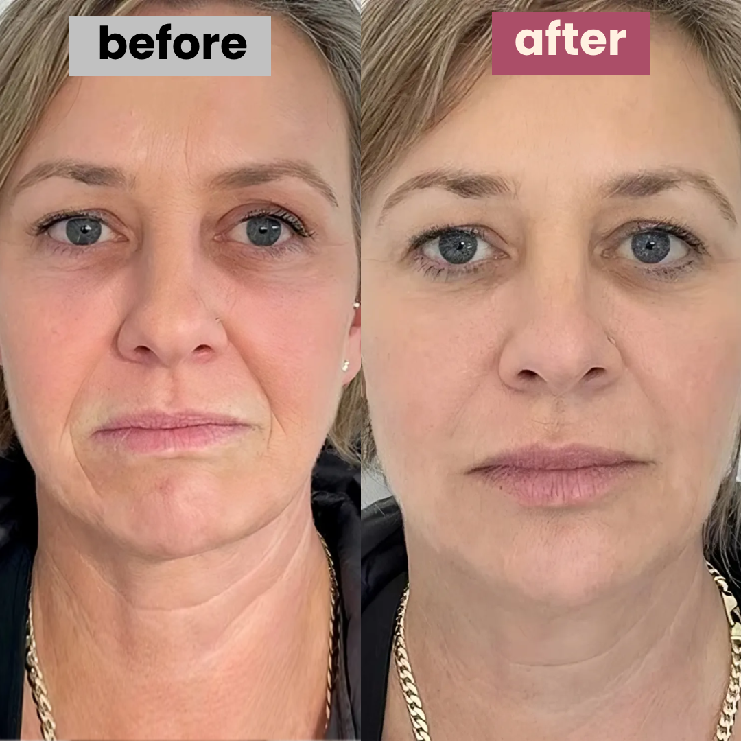 vitamin-c masks