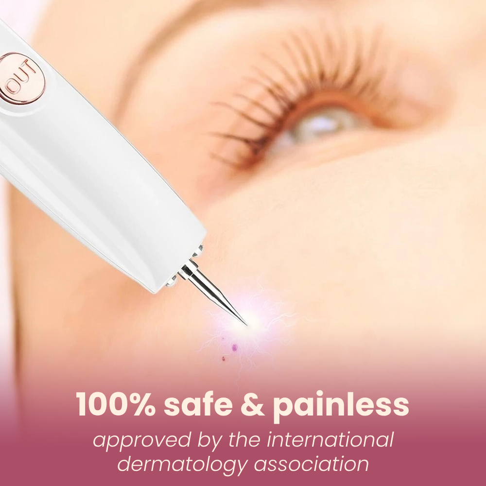 DermaGlow PRO remover pen for moles, age spots, warts & freckles