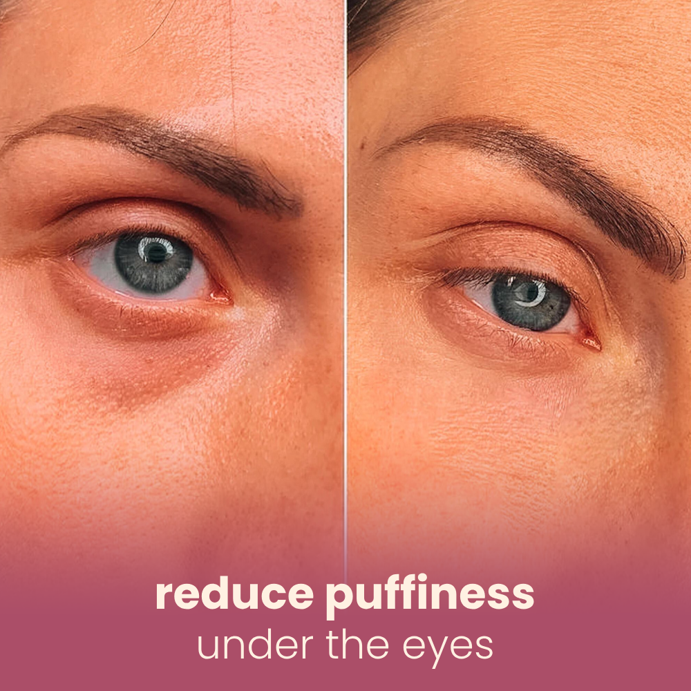 hydrating & plumping microneedling patches