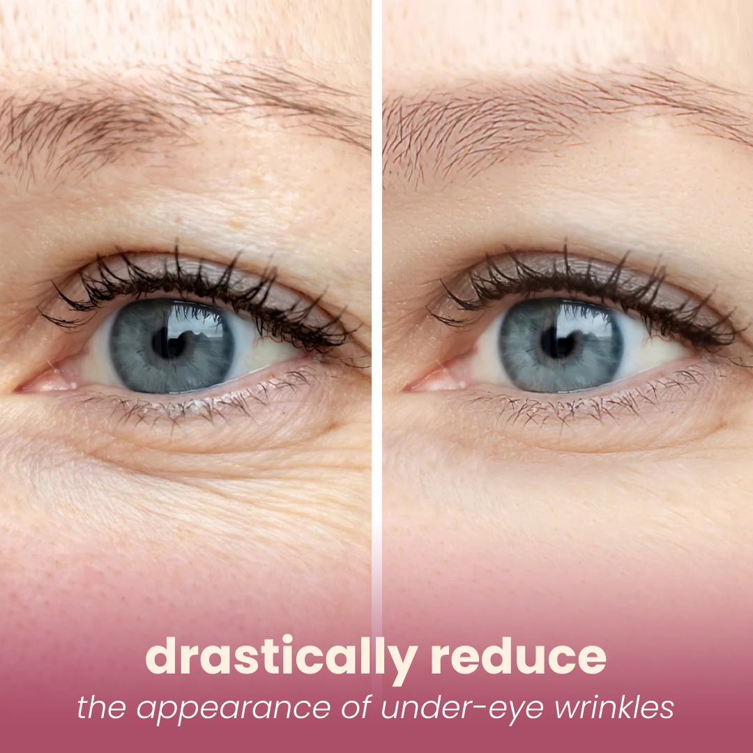 hydrating & plumping microneedling patches
