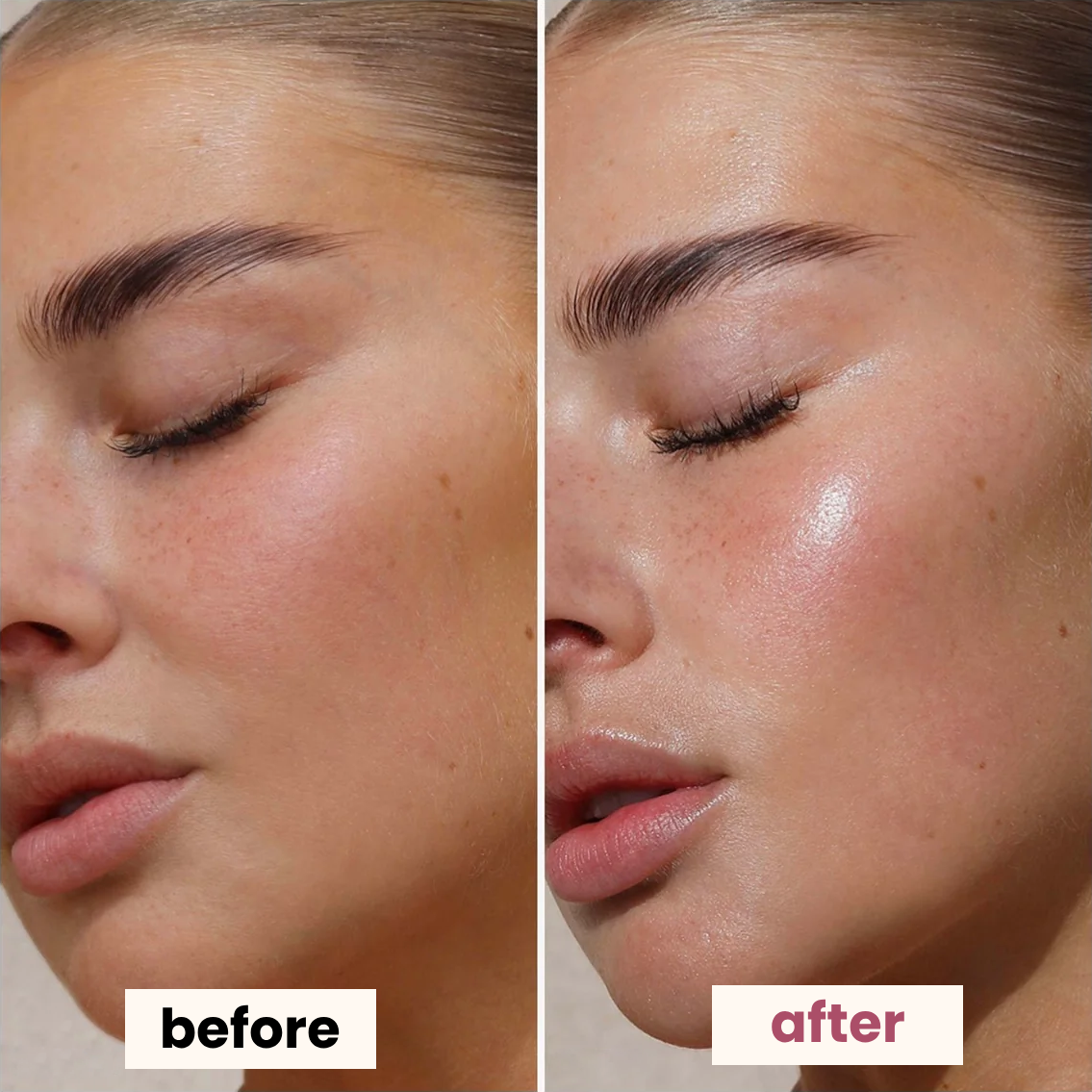 bio-collagen mask