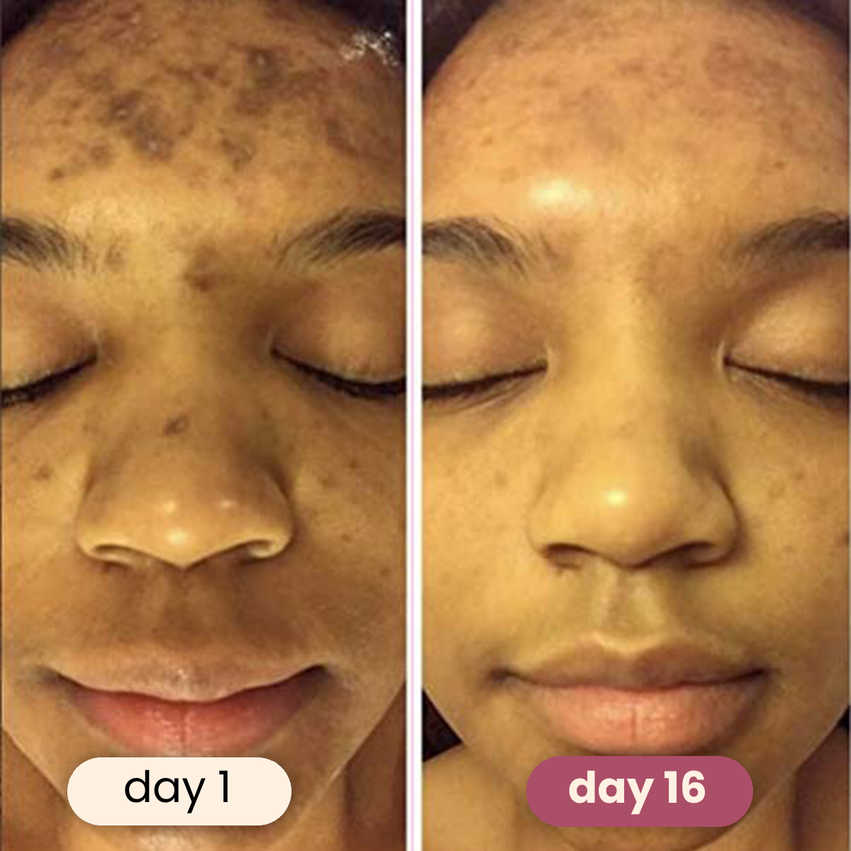 Brightening Kojic Acid & Turmeric Pads