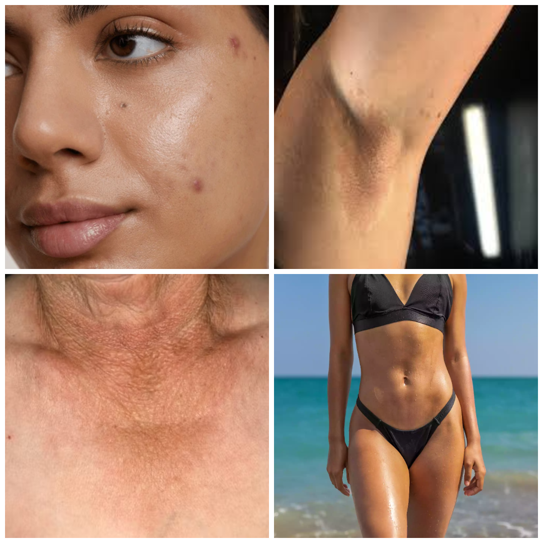 gempages_568168911325889445-fcdb0424-bdb9-460d-9477-f629cdfda52a.png?v\u003d477639974400809702