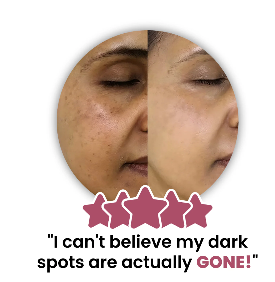 Customer before and after — dark spots faded