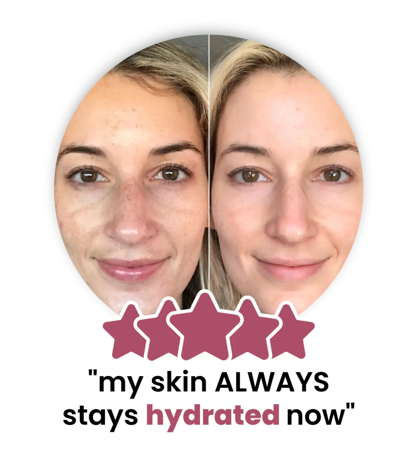Customer before and after — hydrated, glowing skin